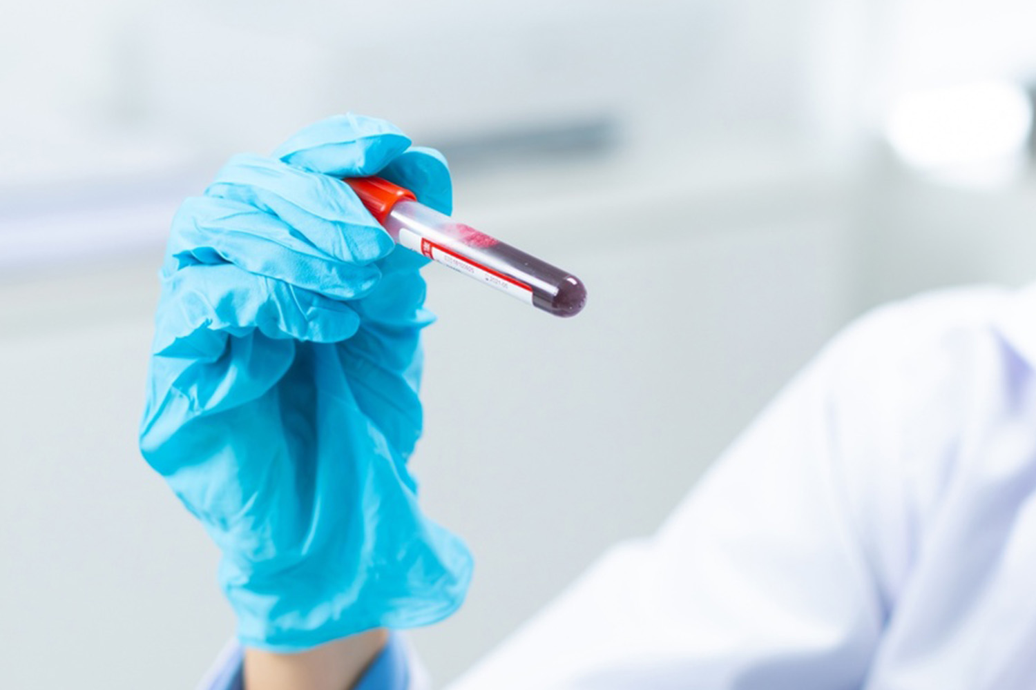 Advanced Screening Tests​